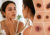 Can Your Skin Reveal Cancer? 7 Warning Signs to Watch For Skin Cancer Warning Signs
