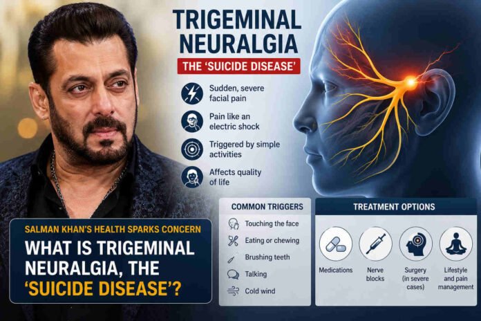 What Is Trigeminal Neuralgia